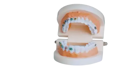 Brackets Brackets