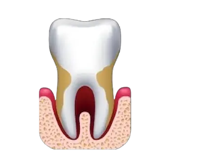 Periodontics image Periodontics image