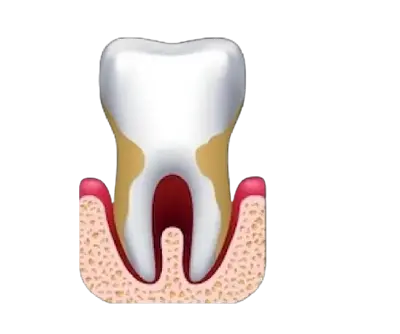 Periodoncia Periodoncia