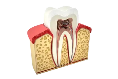 Root canal image Root canal image