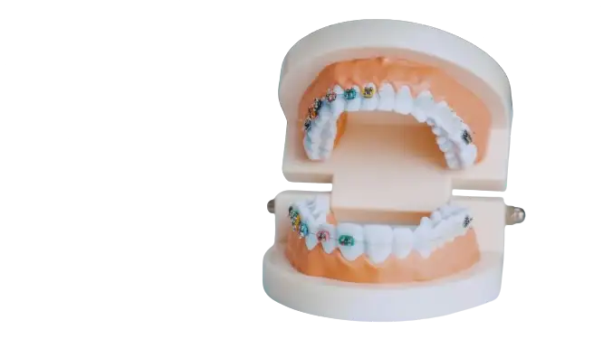 Brackets image Brackets image