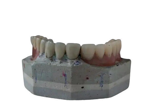 restored dental restored dental