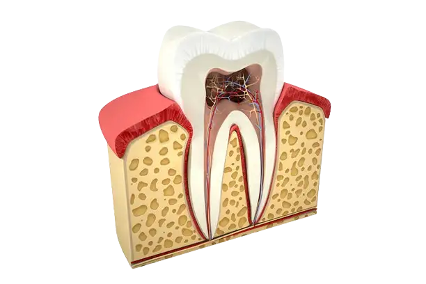 Root canal image Root canal image